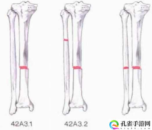 好想c1v3骨科